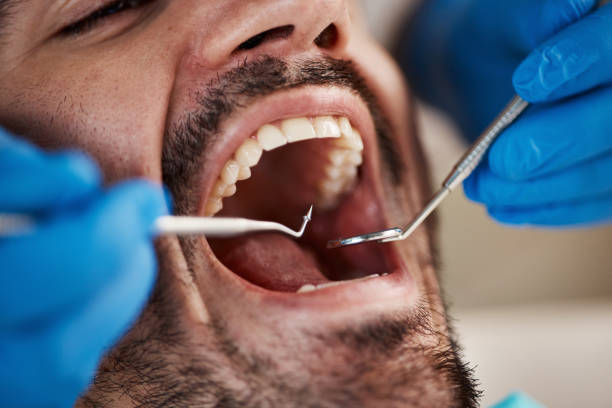 Best Emergency Dentist for Knocked-Out Tooth in Alondra Park, CA